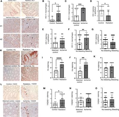 Free heme exacerbates colonic injury induced by anti-cancer therapy
